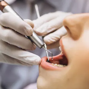 Лечение зубов под микроскопом